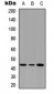 Anti-Serpin B3/4 Antibody