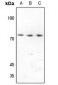 Anti-CD92 Antibody