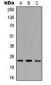 Anti-SRA Antibody