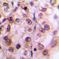 Anti-MST1/2 (pT183) Antibody