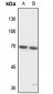 Anti-TCF4/12 Antibody