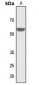 Anti-ZIC1/2/3/4/5 Antibody