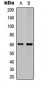 Anti-Ephrin B1/2 Antibody