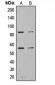 Anti-PI3K p85 alpha/p55 gamma (pY467/199) Antibody