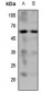 Anti-5-HT7 Antibody