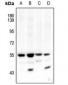 Anti-AKT1/2 (pT308/309) Antibody