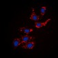 Anti-Collagen 18 alpha 1 Antibody