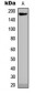 Anti-Collagen 18 alpha 1 Antibody