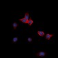 Anti-EPHA2 Antibody