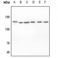 Anti-EPHA2 Antibody