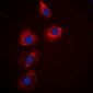 Anti-PAK1/2/3 Antibody