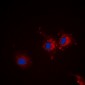 Anti-p67 Antibody