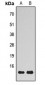 Anti-VAMP1/2/3 Antibody