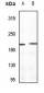 Anti-Sugen Kinase 269 Antibody