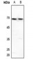Anti-GTF2H1 Antibody