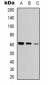 Anti-Glycerol Kinase 1 Antibody