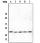 Anti-ASF1B Antibody