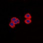Anti-CPI17 Antibody