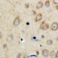 Anti-CPI17 Antibody