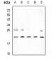 Anti-CPI17 Antibody