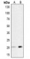 Anti-HSP20 (pS16) Antibody