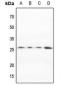 Anti-MARCH2 Antibody