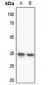 Anti-HOXD13 Antibody