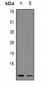 Anti-MYCBP Antibody