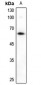 Anti-Alpha-taxilin Antibody