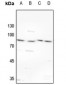 Anti-TBX2/3 Antibody