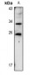 Anti-TIG1 Antibody