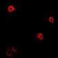 Anti-GPRC5D Antibody