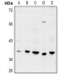 Anti-GPRC5D Antibody