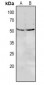 Anti-CD85e Antibody