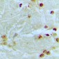 Anti-MED13L Antibody