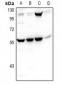 Anti-PHAX Antibody