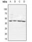 Anti-GTF3A Antibody