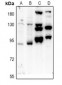 Anti-PTPN22 Antibody
