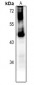 Anti-GPR151 Antibody