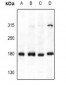 Anti-Collagen IV Antibody