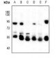 Anti-Cytokeratin-5/6 Antibody