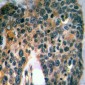 Anti-Mast Cell Tryptase Antibody
