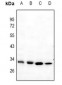 Anti-Mast Cell Tryptase Antibody