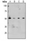 Anti-CaMK2 alpha/beta/delta (pT305) Antibody