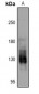 Anti-PKN1/2 (pT774/816) Antibody