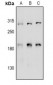 Anti-Girdin Antibody