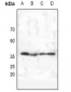 Anti-AMPK gamma 1/2/3 Antibody