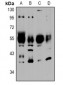 Anti-NTR2 Antibody