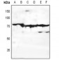 Anti-EMR3 Antibody