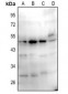 Anti-CD1a/b Antibody